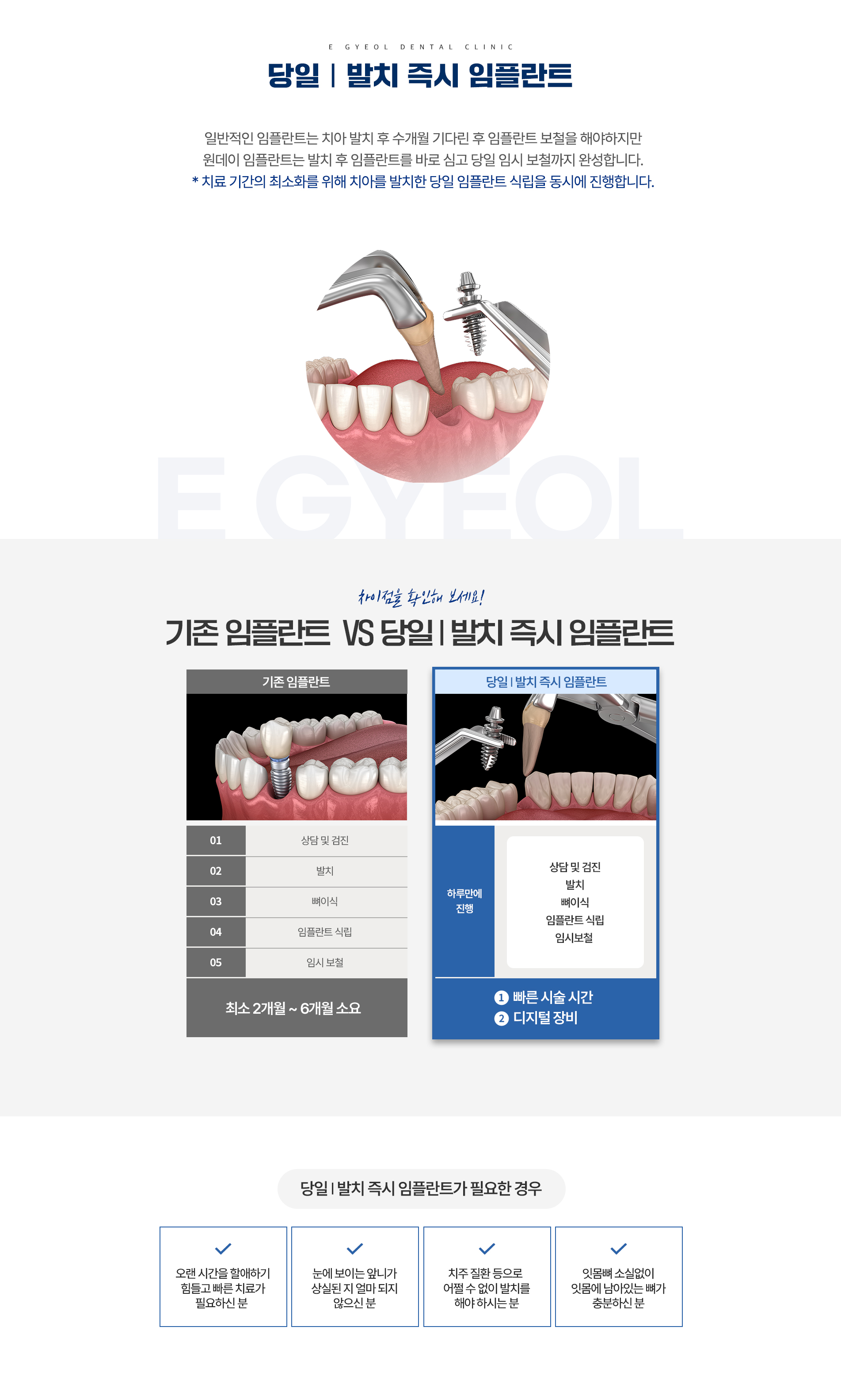 당일/발치 즉시 임플란트