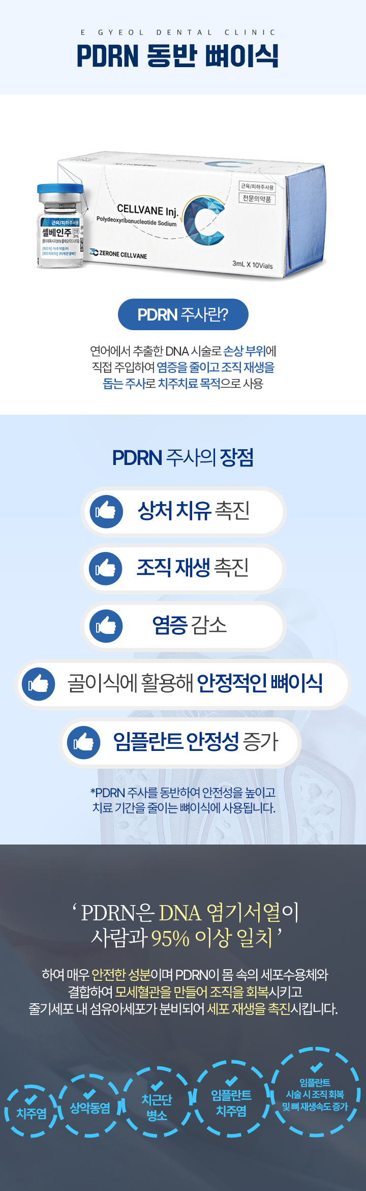 PDRN 동반 뼈이식