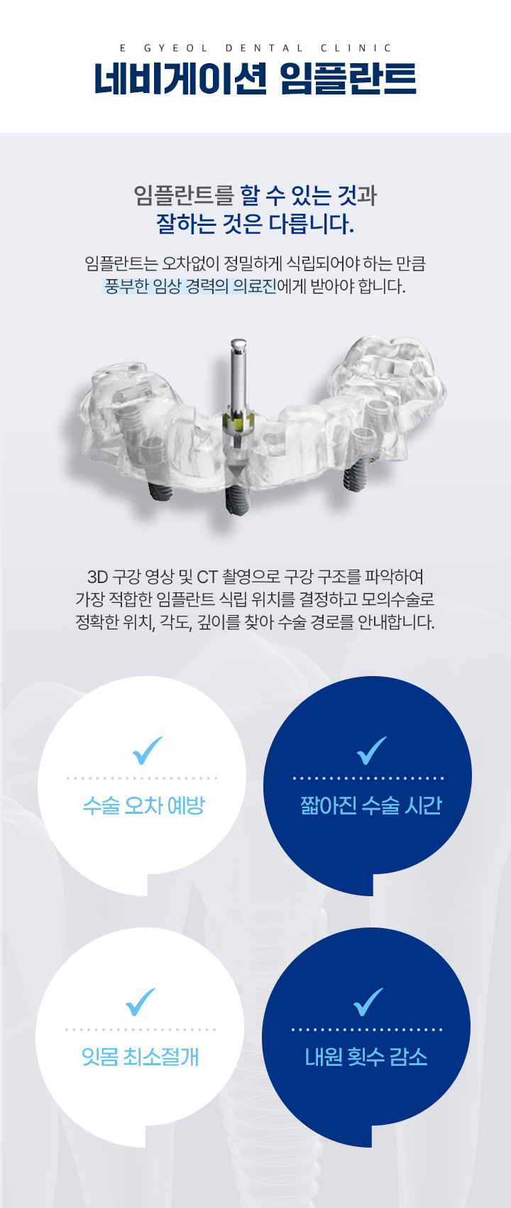 네비게이션 임플란트